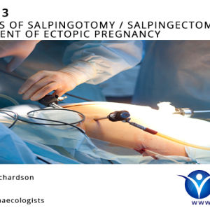 Module 1 – Ergonomics of Laparoscopic Surgery & Risk Assessment